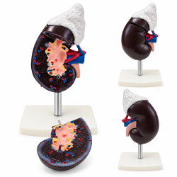 Human Kidney and Adrenal Gland Model - Life-Size, 2 Parts