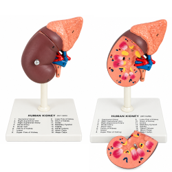 Human Kidney Anatomical Model with 16 Labeled Structures